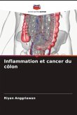 Inflammation et cancer du côlon