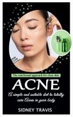 Acne (eBook, ePUB)