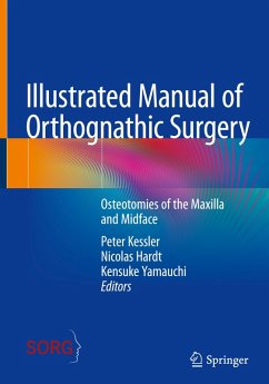 Illustrated Manual of Orthognathic Surgery