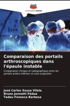 Comparaison des portails arthroscopiques dans l'épaule instable - Souza Vilela, José Carlos;Jannotti Pádua, Bruno;Fonseca Barbosa, Tadeu