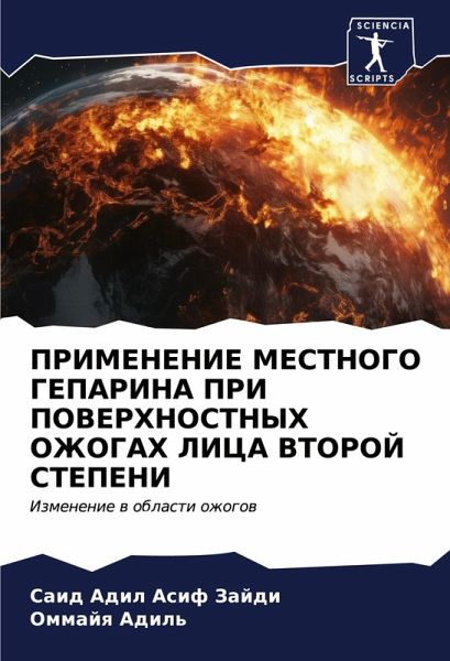 PRIMENENIE MESTNOGO GEPARINA PRI POVERHNOSTNYH OZhOGAH LICA VTOROJ STEPENI