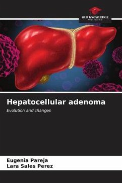 Hepatocellular adenoma - Pareja, Eugenia;Sales Perez, Lara