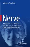 Nerve (eBook, PDF)
