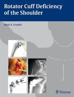 Rotator Cuff Deficiency of the Shoulder (eBook, ePUB)
