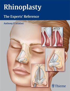 Cover Rhinoplasty (eBook, ePUB)