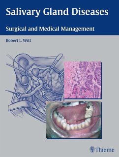 Cover Salivary Gland Diseases (eBook, ePUB)