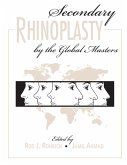 Secondary Rhinoplasty by the Global Masters (eBook, ePUB)