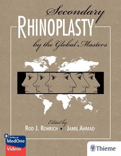 Secondary Rhinoplasty by the Global Masters (eBook, ePUB) - Rohrich, Rod J.; Ahmad, Jamil