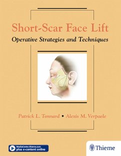 Short-Scar Face Lift (eBook, ePUB) - Tonnard, Patrick; Verpaele, Alexis