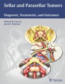 Sellar and Parasellar Tumors (eBook, ePUB)