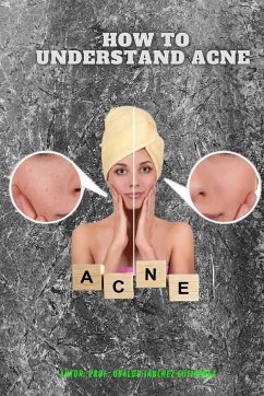 How to understand Acne - Gutiérrez, Ubaldo Sánchez