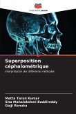 Superposition céphalométrique