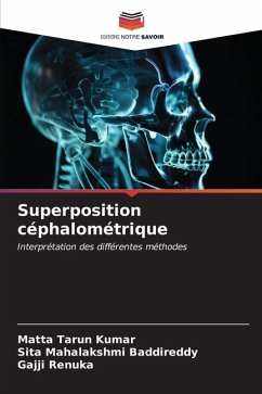 Superposition céphalométrique - Tarun Kumar, Matta;Baddireddy, Sita Mahalakshmi;Renuka, Gajji