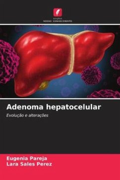 Adenoma hepatocelular - Pareja, Eugenia;Sales Perez, Lara