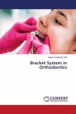 Bracket System in Orthodontics