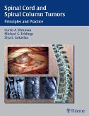 Spinal Cord and Spinal Column Tumors (eBook, ePUB)