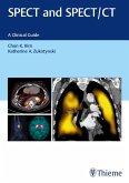 SPECT and SPECT/CT (eBook, ePUB)