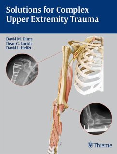 Solutions for Complex Upper Extremity Trauma (eBook, ePUB)