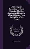 Lithotomy and Extraction of Stone From the Bladder, Urethra, and Prostate of the Male and From the Bladder of the Female