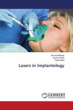 Lasers in Implantology