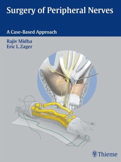 Cover Surgery of Peripheral Nerves (eBook, ePUB)