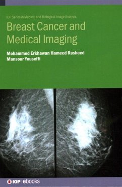 Breast Cancer and Medical Imaging - Hameed Rasheed, Mohammed Erkhawan; Youseffi, Mansour