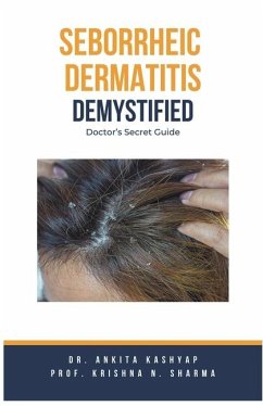 Seborrheic Dermatitis Demystified - Kashyap, Ankita; Sharma, Krishna N