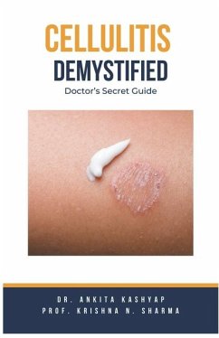 Cellulitis Demystified - Kashyap, Ankita; Sharma, Krishna N