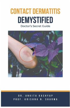 Contact Dermatitis Demystified - Kashyap, Ankita; Sharma, Krishna N