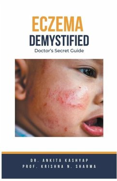 Eczema Demystified - Kashyap, Ankita; Sharma, Krishna N