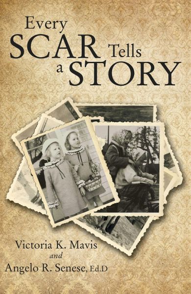 Every Scar Tells a Story (eBook, ePUB) Every Scar Tells a Story (eBook, ePUB)