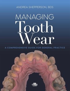 Managing Tooth Wear - Shepperson, Andrea