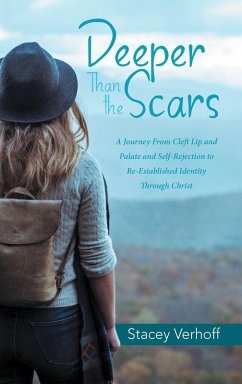 Deeper Than the Scars (eBook, ePUB) - Verhoff, Stacey