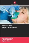 Lasers em Implantodontia