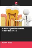 Lesões periodontais endodônticas