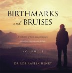 Birthmarks and Bruises (eBook, ePUB)