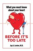 What You Must Know About Your Heart Before It's Too Late (eBook, ePUB) What You Must Know About Your Heart Before It's Too Late (eBook, ePUB)
