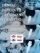 Dental Implant Treatment Planning for... - Bild 1