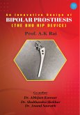 An innovative design of bipolar prosthesis (eBook, ePUB)