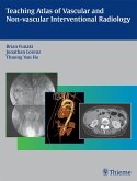 Teaching Atlas of Vascular and Non-vascular Interventional Radiology (eBook, ePUB)