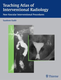 Cover Teaching Atlas of Interventional Radiology (eBook, ePUB)