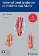 Tethered Cord Syndrome in Children and... - Bild 1