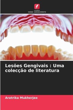 Lesões Gengivais : Uma colecção de literatura - Mukherjee, Aratrika