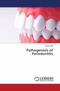 Pathogenesis of Periodontitis - Patel, Faraz