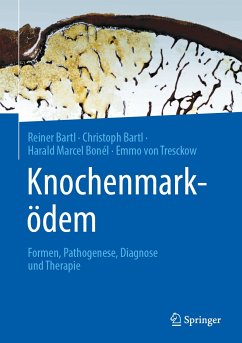 Knochenmarködem (eBook, PDF) - Bartl, Reiner; Bartl, Christoph; Bonél, Harald Marcel; von Tresckow, Emmo