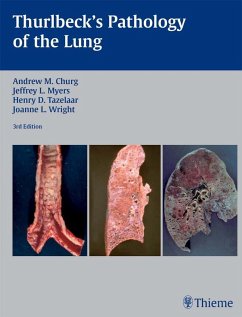 Thurlbeck's Pathology of the Lung (eBook, ePUB) - Churg, Andrew M.; Myers, Jeffrey L.; Tazelaar, Henry D.; Wright, Joanne L.