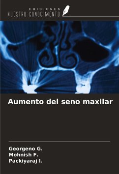 Cover Aumento del seno maxilar
