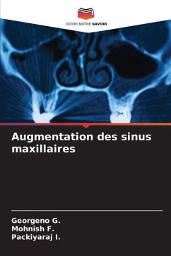 Augmentation des sinus maxillaires - G., Georgeno;F., Mohnish;I., Packiyaraj