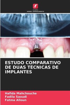 ESTUDO COMPARATIVO DE DUAS TÉCNICAS DE IMPLANTES - Mahchouche, Hafida;Saoudi, Fadila;Alloun, Fatma