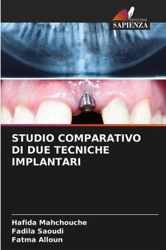 STUDIO COMPARATIVO DI DUE TECNICHE IMPLANTARI - Mahchouche, Hafida;Saoudi, Fadila;Alloun, Fatma